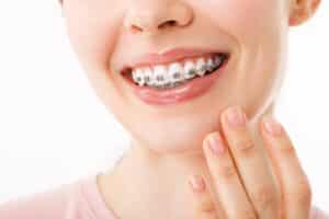 Teenager smiles, showing braces in Salem, MA